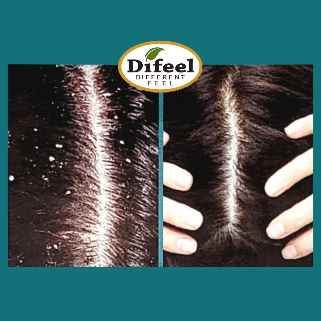 Shampoing scalp care Peppermint - DIFEEL